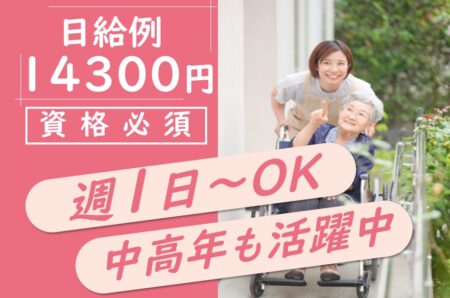 小規模施設の介護職 